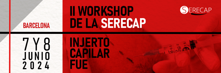 II Workshop de la SERECAP