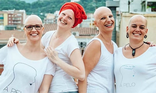 El gran tabú de la alopecia femenina